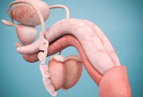 Testicular Torsion